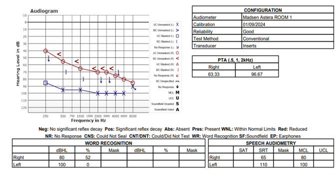 Audiologist's Report/Audiogram Examples